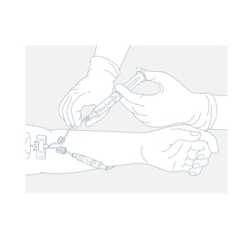 Mono line illustration of a diagram illustrating infusion therapy by administration of medication thru intramuscular injection, needle or catheter done in monoline style.