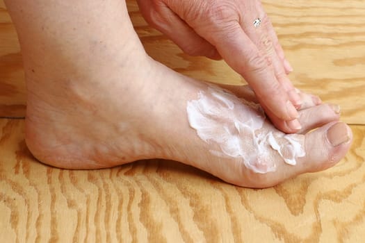 A woman creams her foot. Foot cream against dry skin and cornea on the foot. Foot cream against athlete's foot