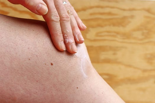 A woman rubs her knee with a pain ointment. Painful osteoarthritis in the knee
