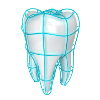 Tooth protection. 3d illustration isolated on white background