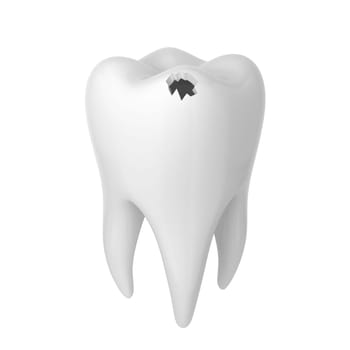 Hole in a tooth. 3d illustration isolated on white background