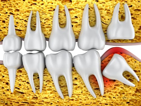 Dental row of molars and an improperly located wisdom tooth. 3d rendering.
