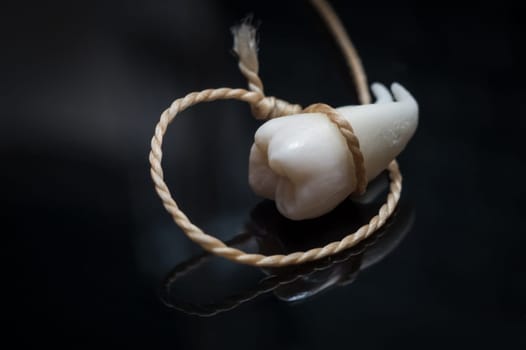A wisdom tooth with roots tied with a thread on a black background.