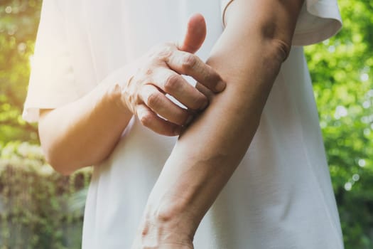 Man scratch itch with hand. Man scratching his arm healthcare concept.