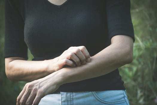 Woman scratch itch with hand. Female scratching her arm. Healthcare and painful concept.