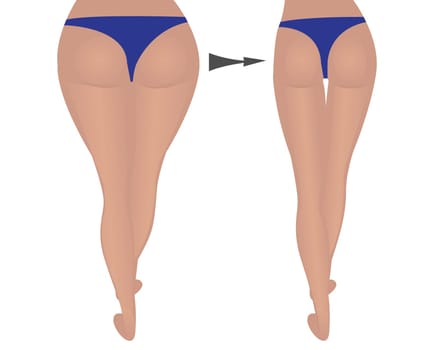 buttocks shape weight loss. Fat and slim thighs hips. before and after vector illustration