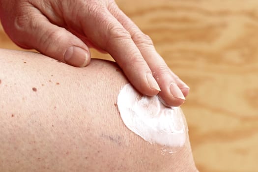 A woman rubs a pain ointment on her knee. Painful arthrosis of the knee
