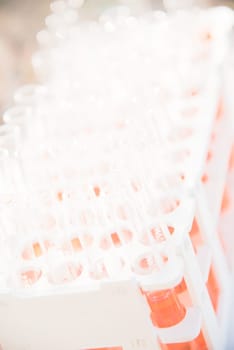 Lab science research glass items adding drop to one of several test tubes. A scientific experiment in a science research Laboratory.