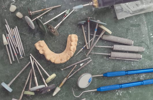 Artificial tooth being done by a dental prosthesis specialist.