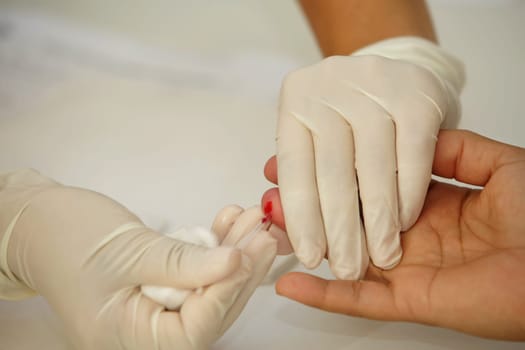 SALVADOR, BAHIA / BRAZIL - July 28, 2017: Blood collection for rapid tests for diagnosis of hepatitis B and C in a public hospital in the city of Salvador (BA) (Joa Souza / Panthermedia).