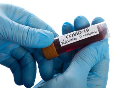Coronavirus COVID-19 Blood Sample. Doctor with test tube in hand.