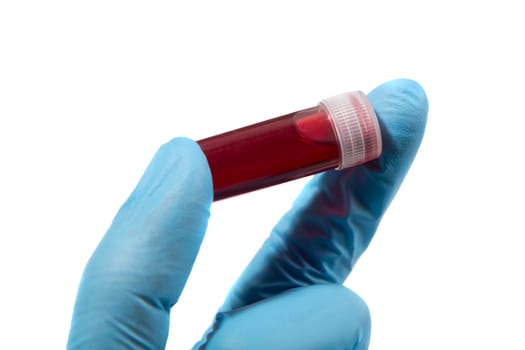 Blood test tube in doctor hand with blue medical gloves.