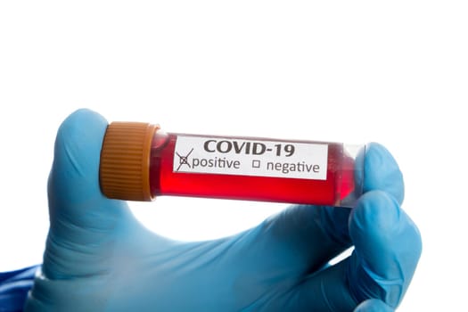 Blood test tube in doctor hand with blue medical gloves.