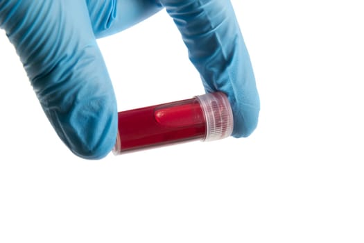Blood test tube in doctor hand with blue medical gloves.