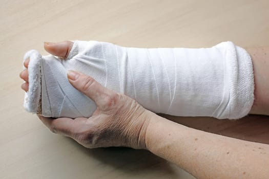A woman has a splint and bandage on an injured hand