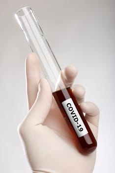 Coronavirus concept. COVID-19. Hand holding blood in test tube close up