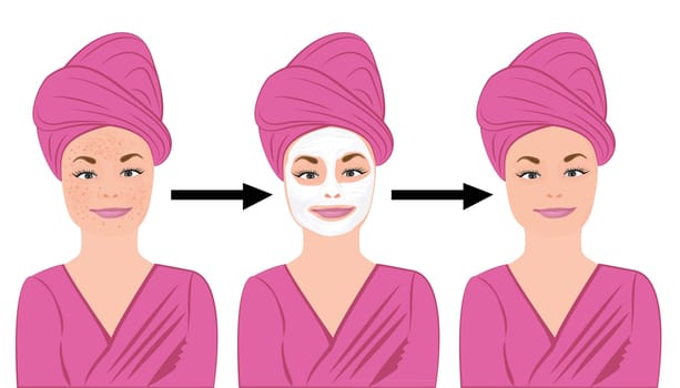 Acne skin disease before and after treatment vector illustration