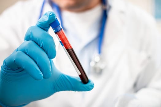 View of a doctor holding a fictional test tube blood sample, possibly infected.