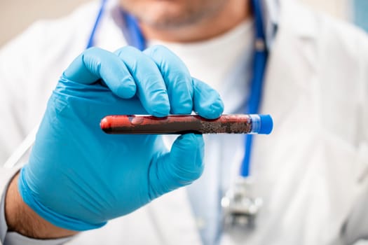 View of a doctor holding a fictional test tube blood sample, possibly infected.