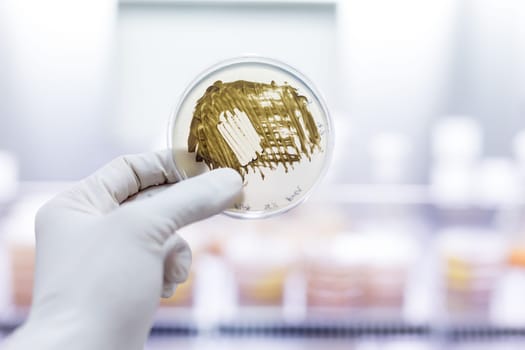 Scientist growing bacteria in petri dishes on agar gel as a part of scientific experiment. Corona virus pandemic concept. Development of virus treatment drug.