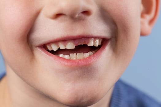 Young boy point on milk tooth. Baby losing teeth. Close up studio male portrait. Missing. Kid mouth gap. Smiling person. Childhood daily dental clean.