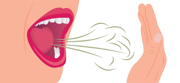 Bad smell air from a mouth. Oral hygiene concept vector illustration on a white background.