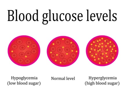 regulations blood sugar level control medical lab analysis vector illustration infographics