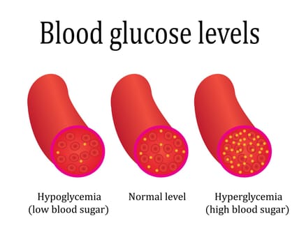 regulations blood sugar level control medical lab analysis vector illustration infographics