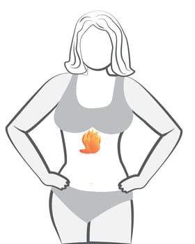 Gastroesophageal reflux disease. Gastritis Heartburn Gerd stomach in a human body vector illustration on a white background