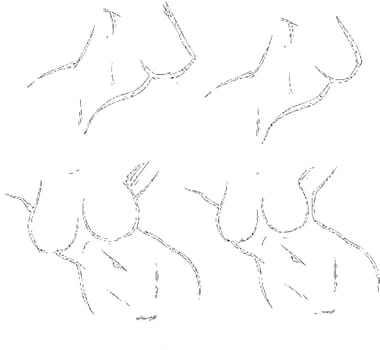 Tutorial of drawing a female body. Drawing the human body, step by step lessons. Female breast drawing tutorial. Drawing a woman's body with an emphasis on breasts.
