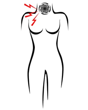 Stilisierter Frauenkörper mit Halsschmerzen