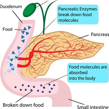 Pancreatic role and functionin digestion process in a human body  vector illustration infographics