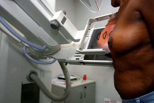 salvador, bahia / brazil - october 22, 2014: woman is seen during mammography exam to detect breast cancer in the city of Salvador.