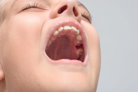 The well after the extraction of the milk tooth in the girl's mouth