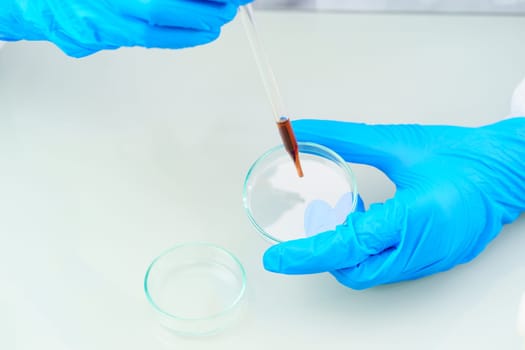 Technician scientist analyzing a blood sample on tray in laboratory for testing it on COVID, COVID-19, coronavirus virus analysis