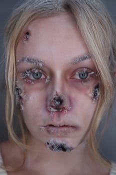 young blond woman with frostbite sfx makeup