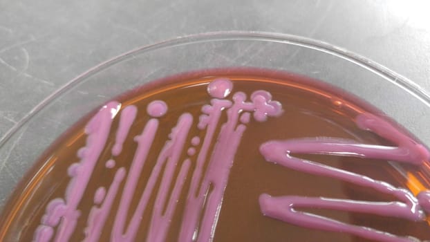 petri dish with various bacteria colonies on agar