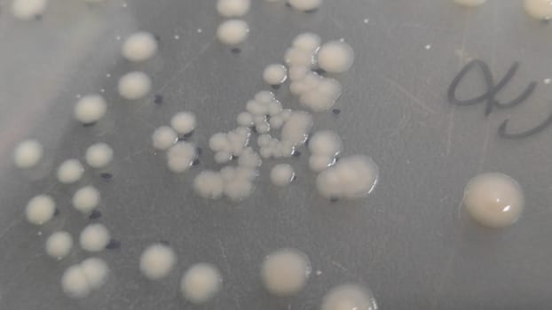 petri dish with various bacteria colonies on agar