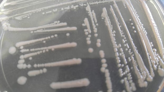 petri dish with various bacteria colonies on agar