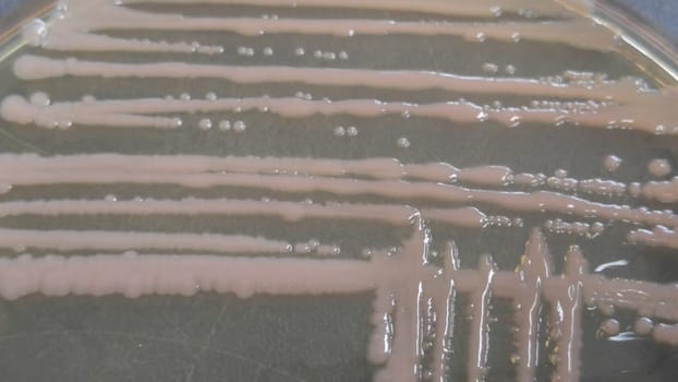 petri dish with various bacteria colonies on agar