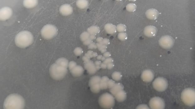 petri dish with various bacteria colonies on agar