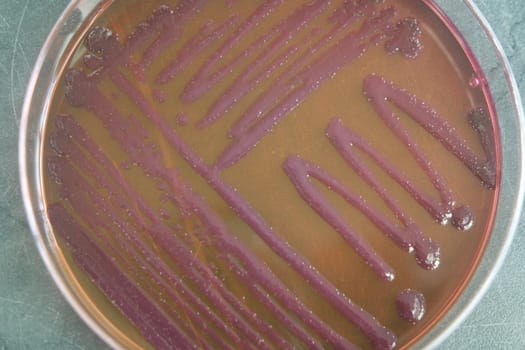 petri dish with various bacteria colonies on agar
