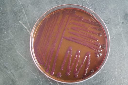 petri dish with various bacteria colonies on agar