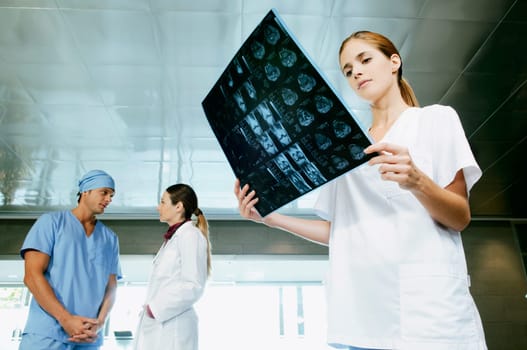 Female nurse examining an X_Ray with her colleagues discussing in the background