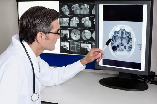 Doctor examining MRI report
