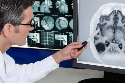 Doctor examining MRI report