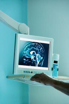 Doctor examining MRI scan on a computer screen