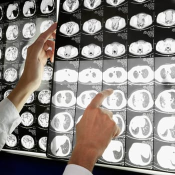 Doctor examining MRI report