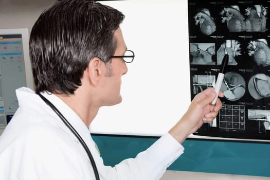 Doctor examining MRI report