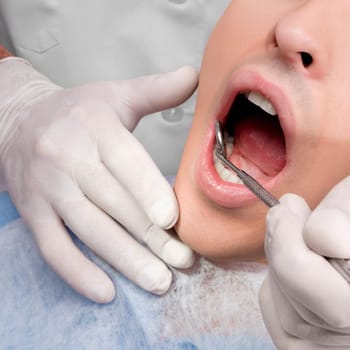 Dentist examining a manŽs teeth